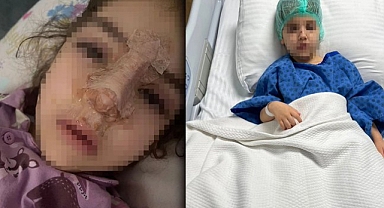 Küçükçekmece'de Skandal: Kız çocuğunun burnunu kırdılar!